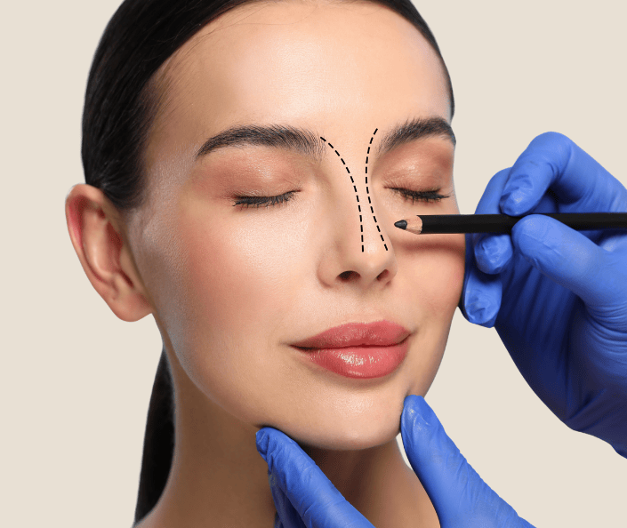 surgeon drawing lines on a woman's nose for rhinoplasty surgery