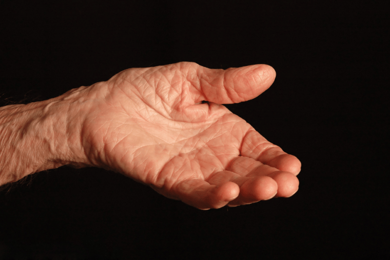 An elderly person’s outstretched hand, palm up, with visible wrinkles and veins, set against a black background—subtle details that are often assessed by a plastic surgery specialist.