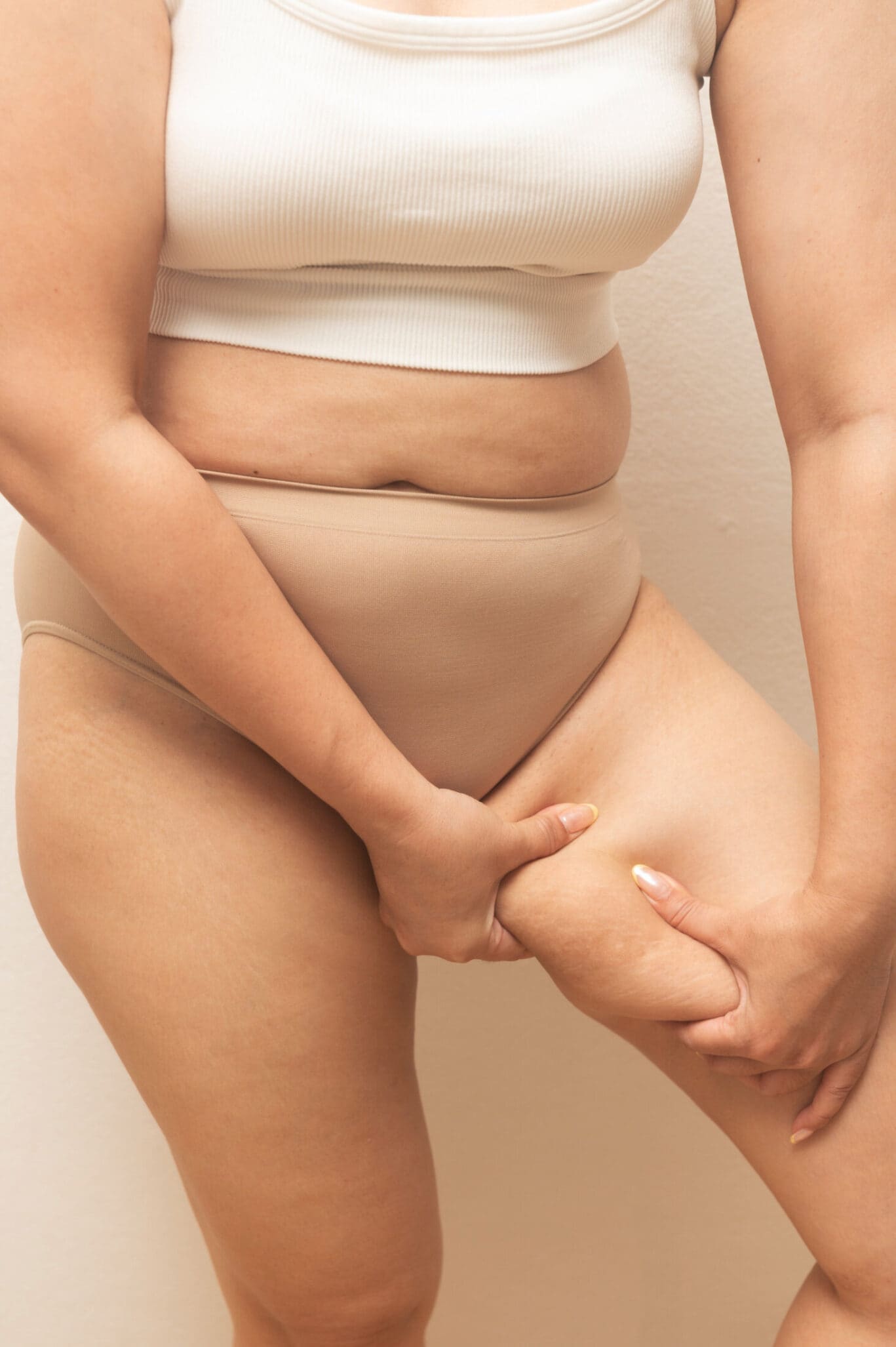 Women showing her excess skin and fat around her thigh. Considering thigh lift plastic surgery