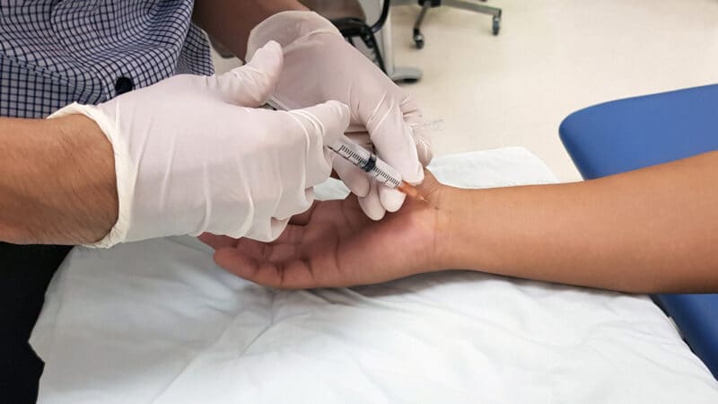 Gloved hands inject a syringe into a patient's wrist while the patient lies on a white cloth, likely for a medical procedure or treatment performed by a specialist in plastic surgery.