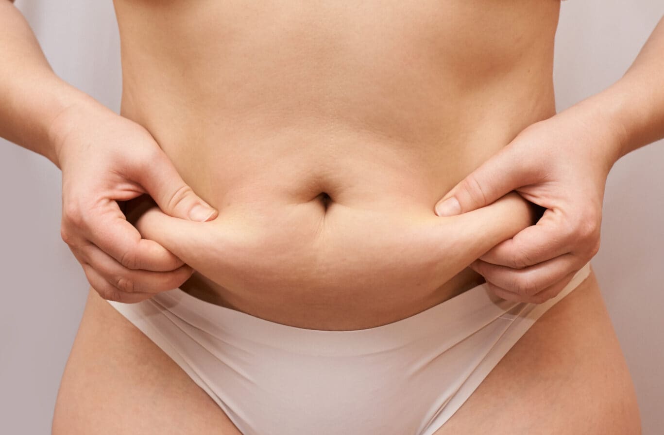 woman demonstrating the need for a tummy lift procedure